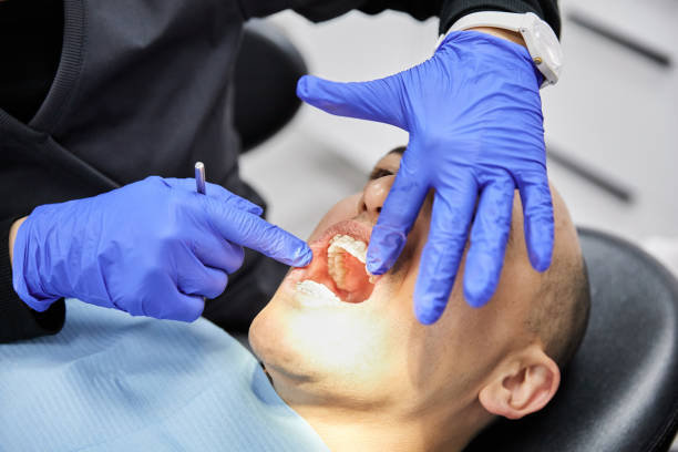 Best Emergency Gum Treatment in Uniontown, OH